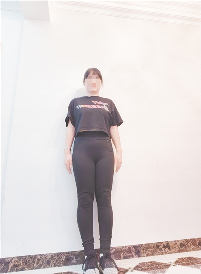 高女士減脂前后對比。